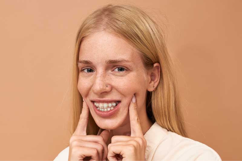 Paciente con brackets cerámicos estéticos sonriendo