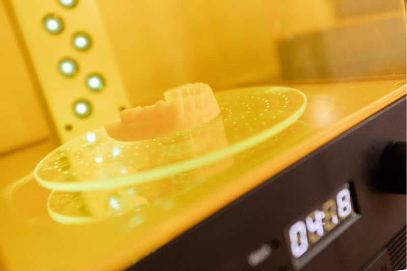 Planificación 3D para cirugía ortognática